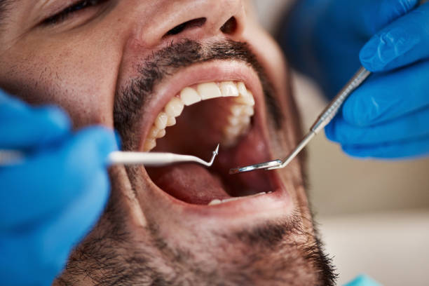 Emergency Dentist for Kids in FL